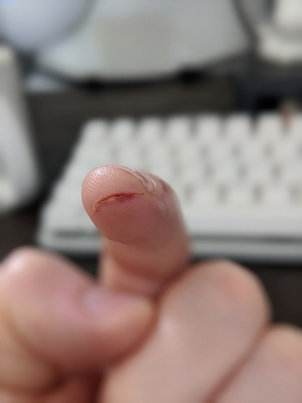 finger cut
