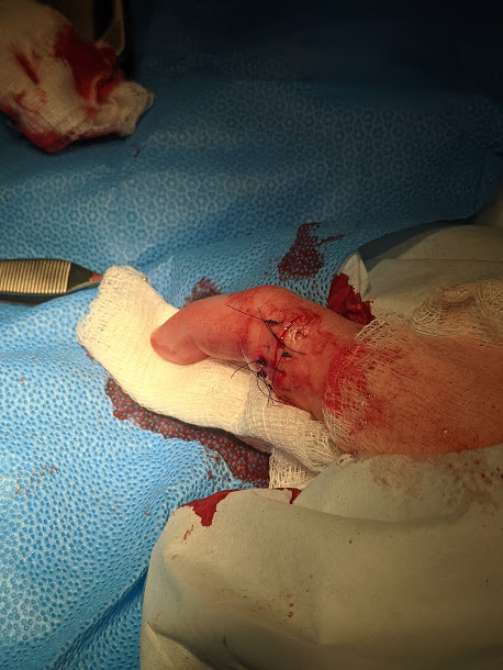 2020 12 26 stitches