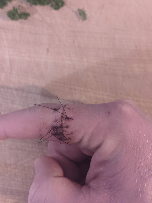 2021 01 02 finger