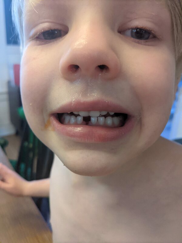tooth